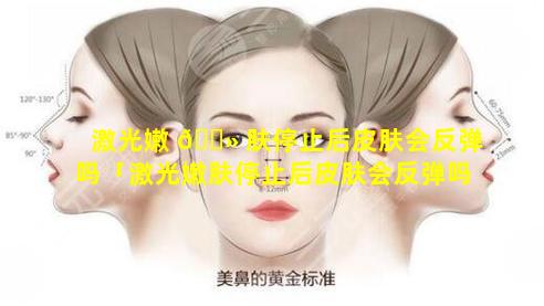 激光嫩 🌻 肤停止后皮肤会反弹吗「激光嫩肤停止后皮肤会反弹吗图片」